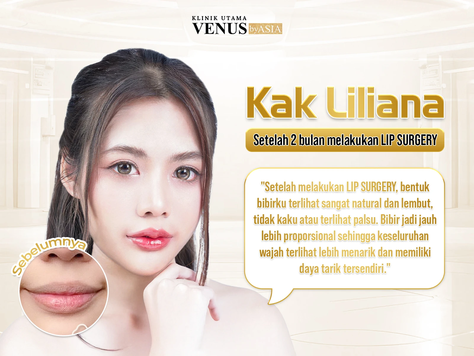 LIP SURGERY – Tren Pembentukan Bibir yang Trendy, Natural, dan Menarik Bibir yang indah tidak hanya