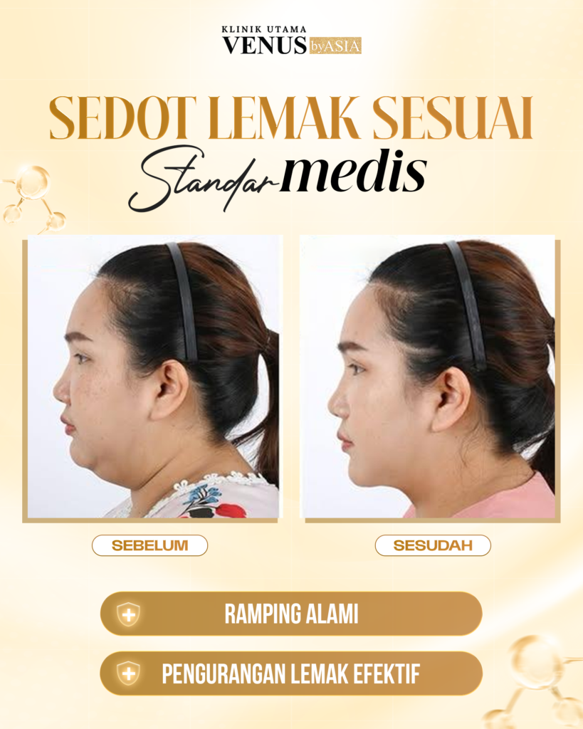 Lipo Suction