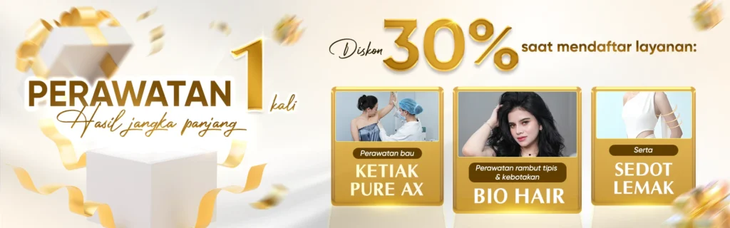 Beranda