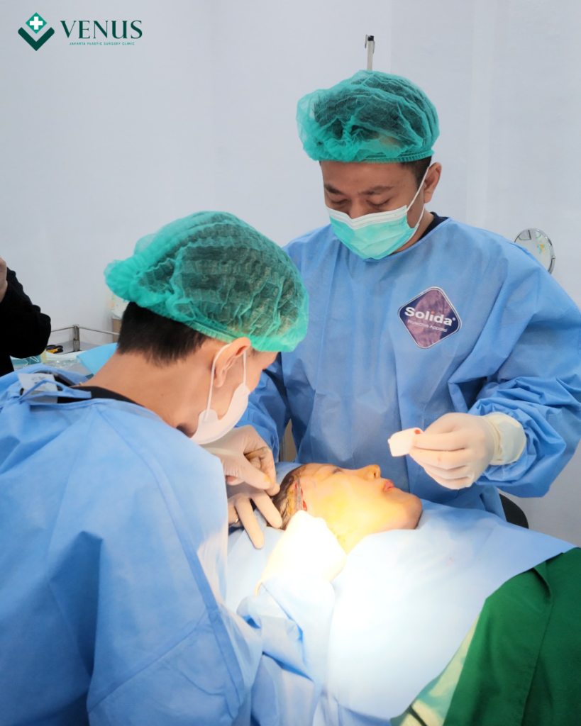 FOREHEAD LIFT