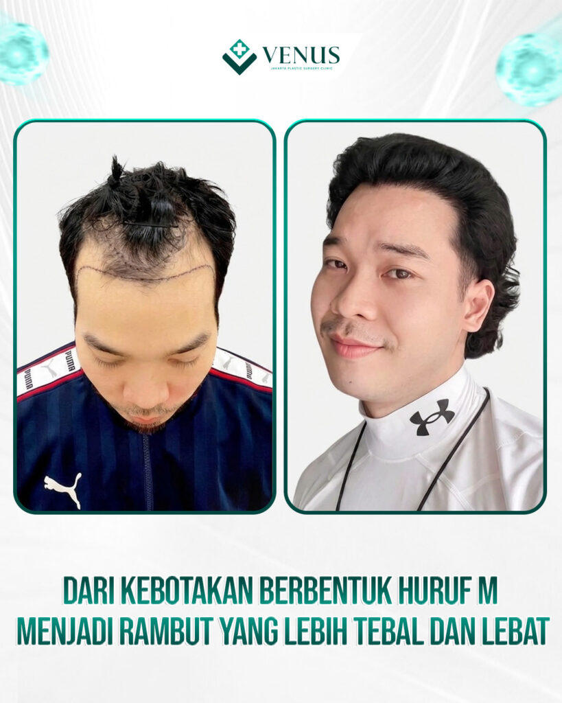 Beranda