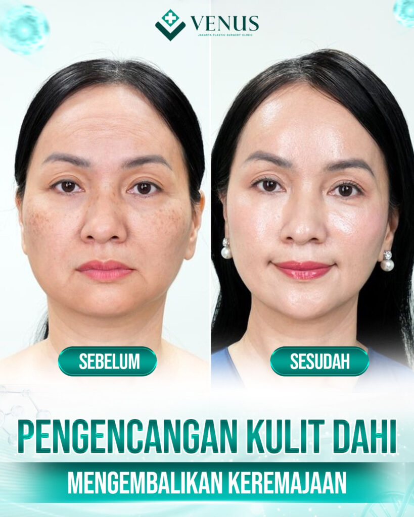 Beranda